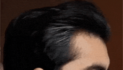 Before After (1).gif__PID:3530117e-24bb-4888-a50a-91e6070302fc